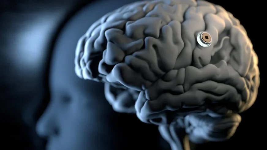 Neuralink планирует ежегодно имплантировать чипы 20 тысячам людей до 2031 года